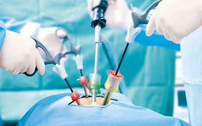 بهترین جراح لاپاراسکوپی در اصفهان
