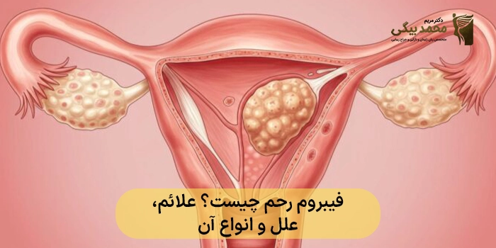فیبروم رحم چیست؟ علائم، علل، انواع آن