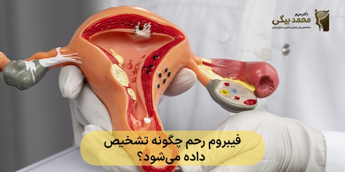 فیبروم رحم چگونه تشخیص داده میشود؟